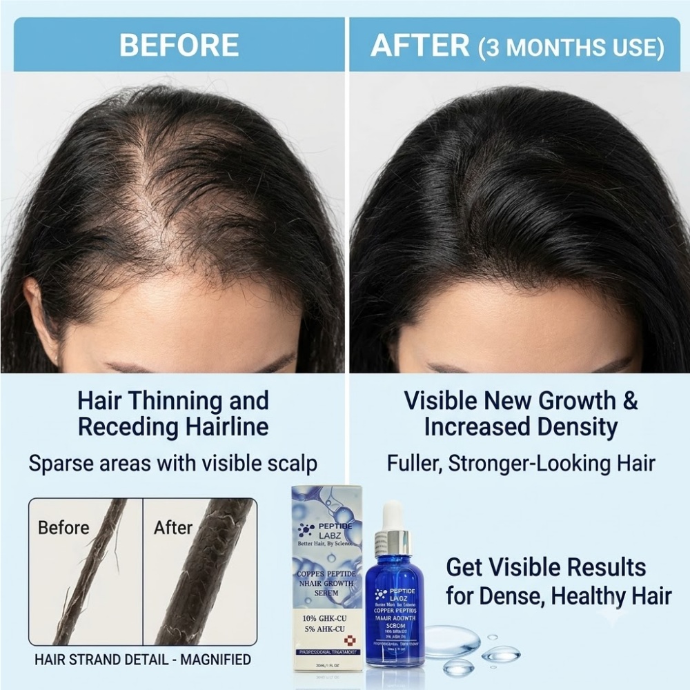 Haar Groei Essentie Koper Pept - Hyaluronic Acid Facial Serum recensie en prijs