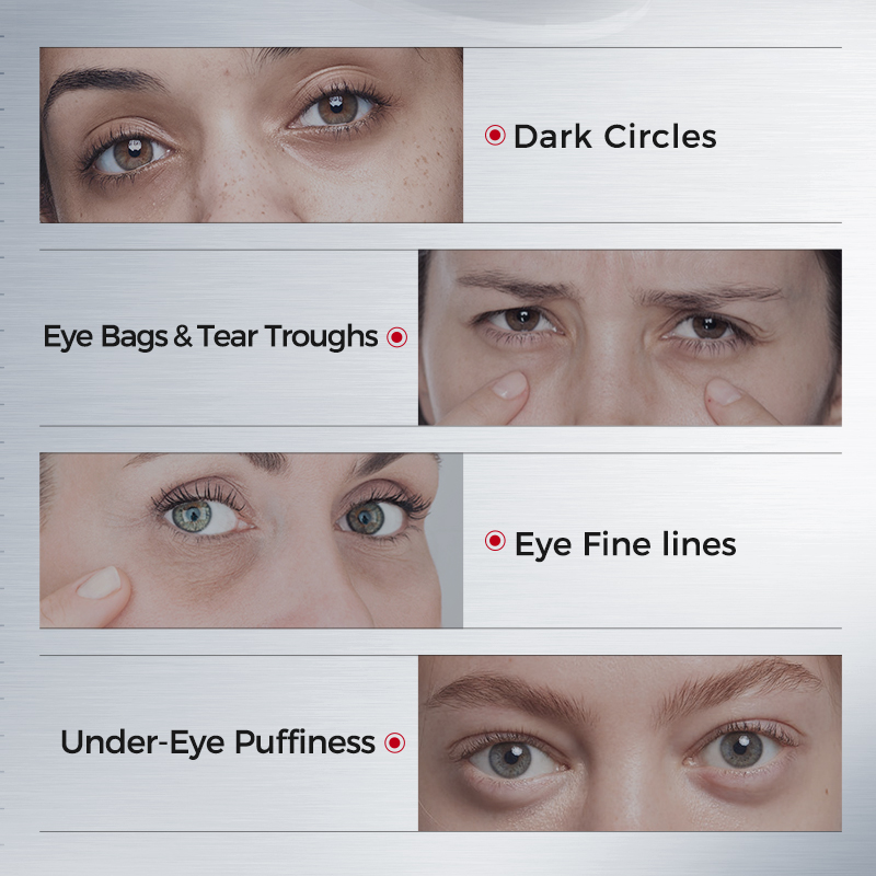 Oogpatches tegen donkere kring - Collagen Under Eye Patches recensie en prijs