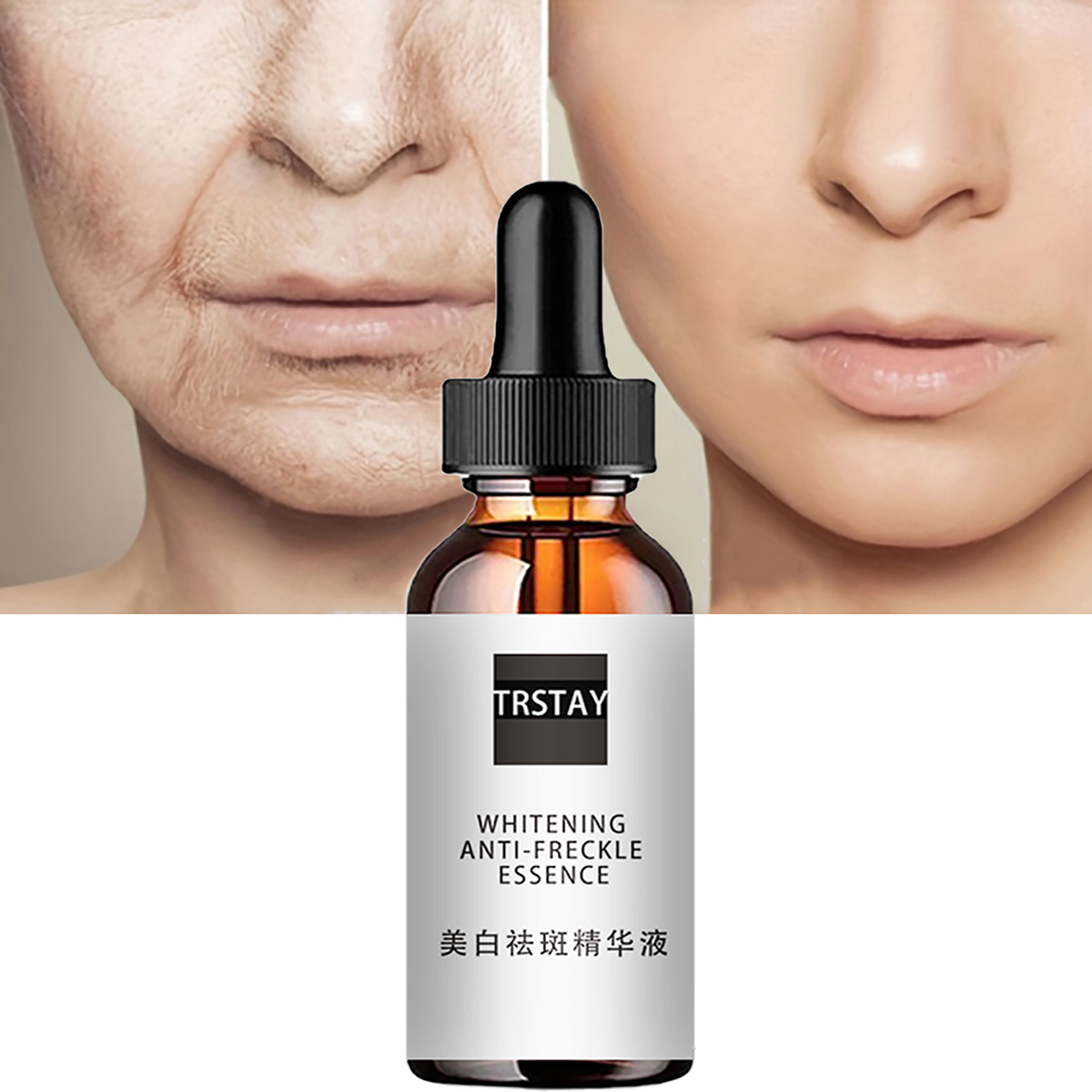 Niacinamide Acid Facial Essenc - Niacinamide Pore Shrinking Essence recensie en prijs